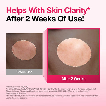 Anua Niacinamide 10 TXA 4 Serum